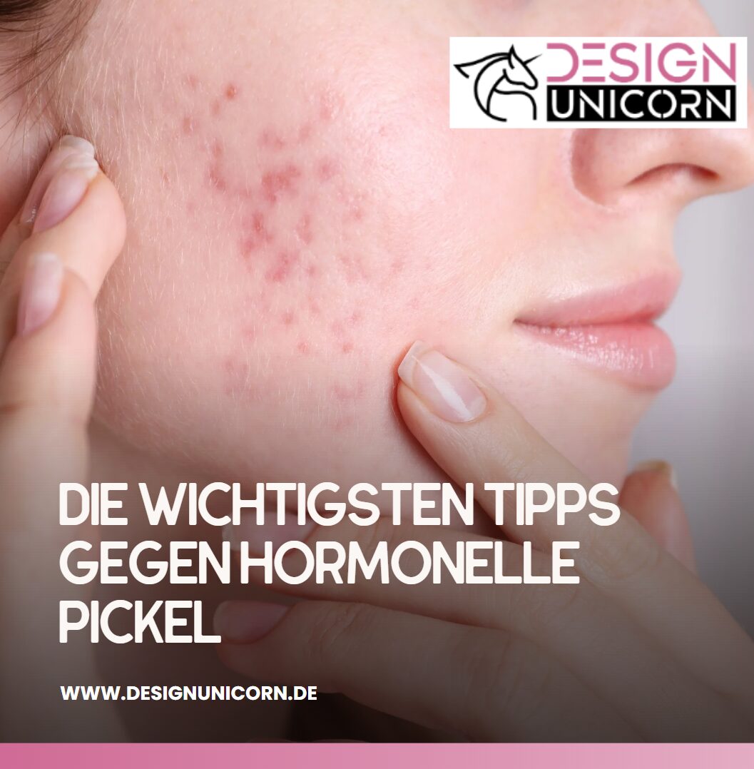 Die wichtigsten Tipps gegen hormonelle Pickel