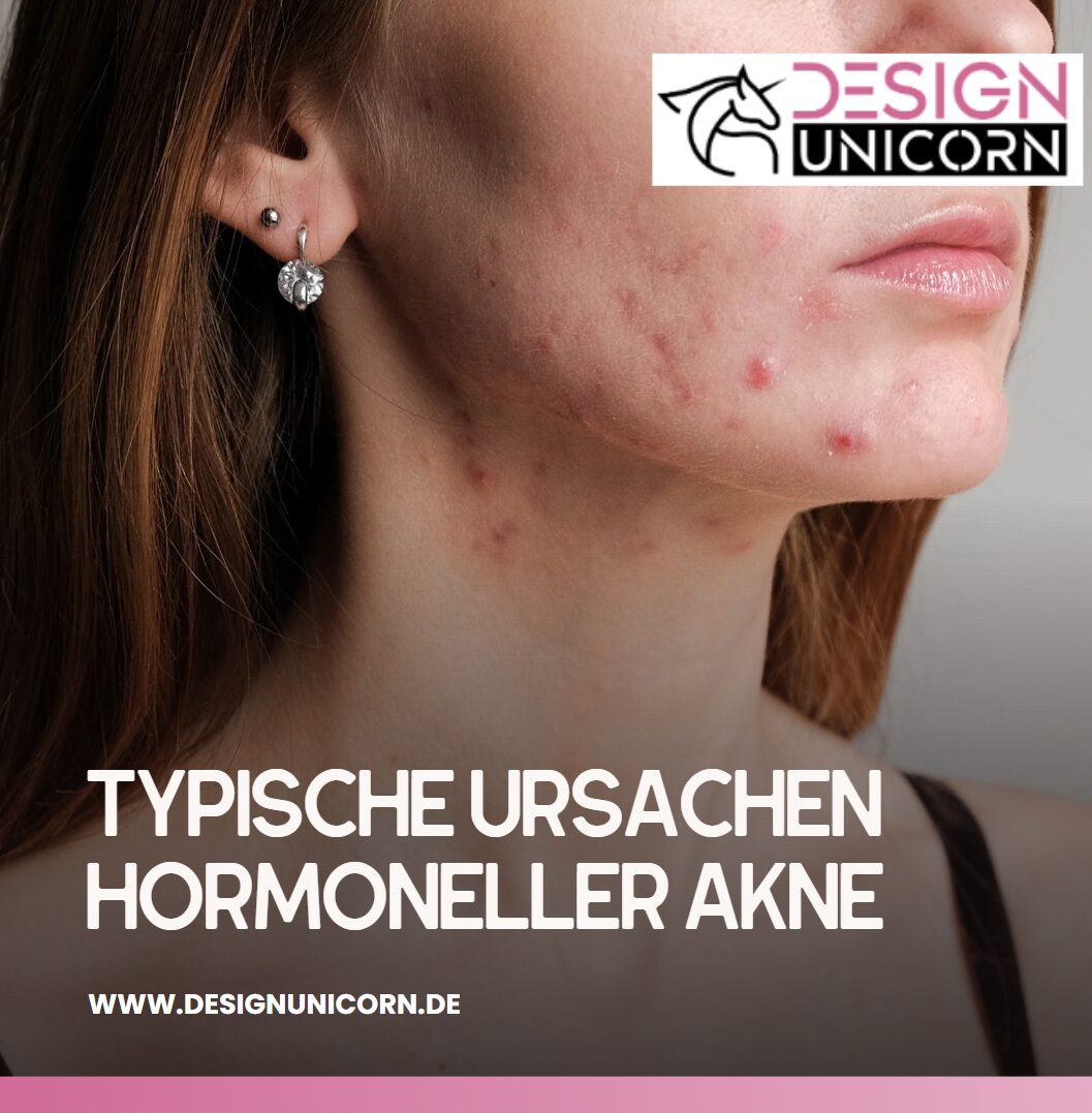 Typische Ursachen hormoneller Akne